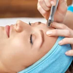 What is Diamond Peel Facial Treatment