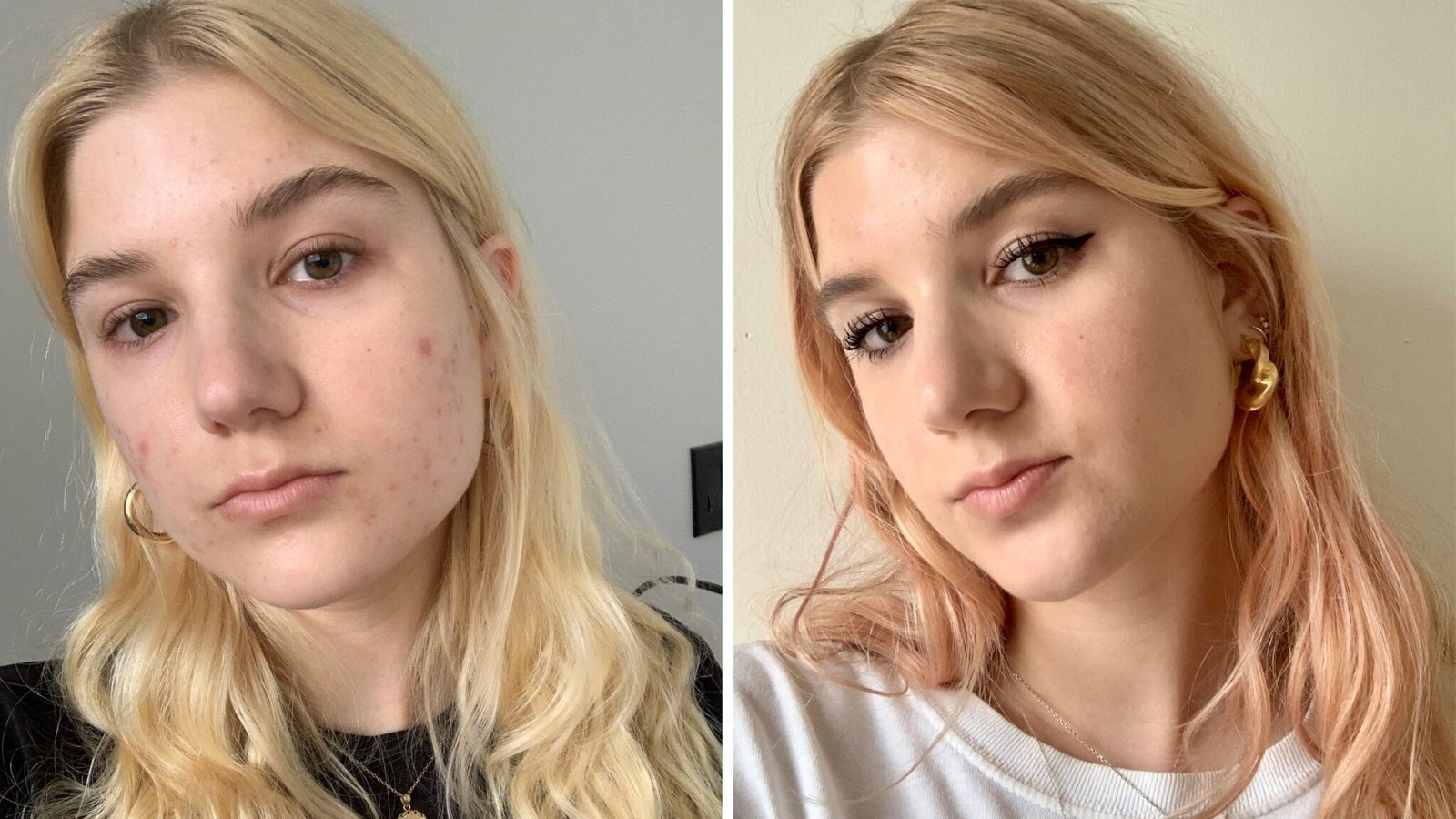 Makeup Vs No Makeup - Facial Adviser