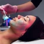 Fire And Ice Facial Vs Microdermabrasion