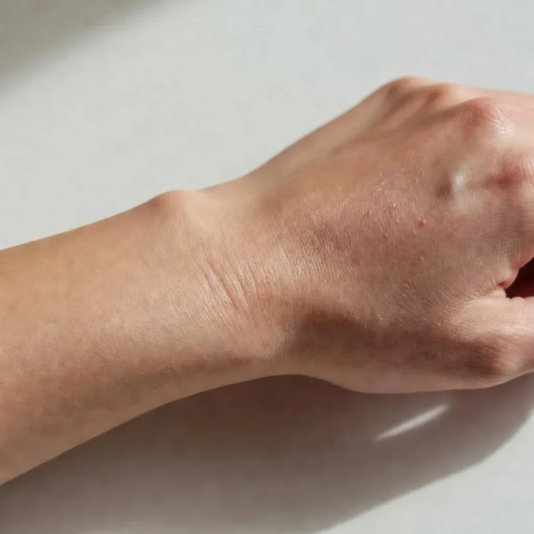 How Diet Impacts Skin Microbiome
